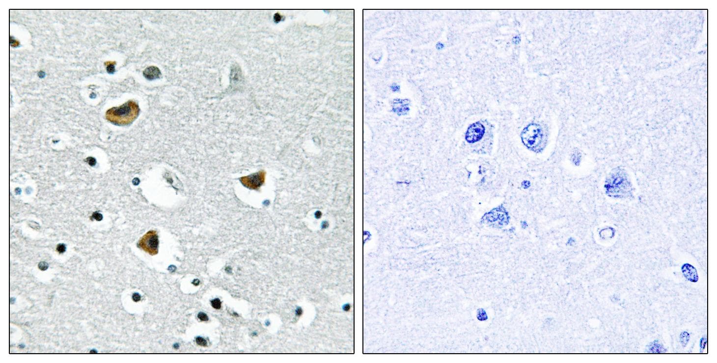 Polyclonal Rabbit anti-Human HMGN2 Antibody (IHC, IF)