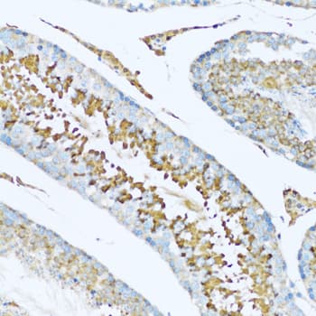 Polyclonal Rabbit anti-Human HPX / Hemopexin Antibody (IHC, IF, WB)