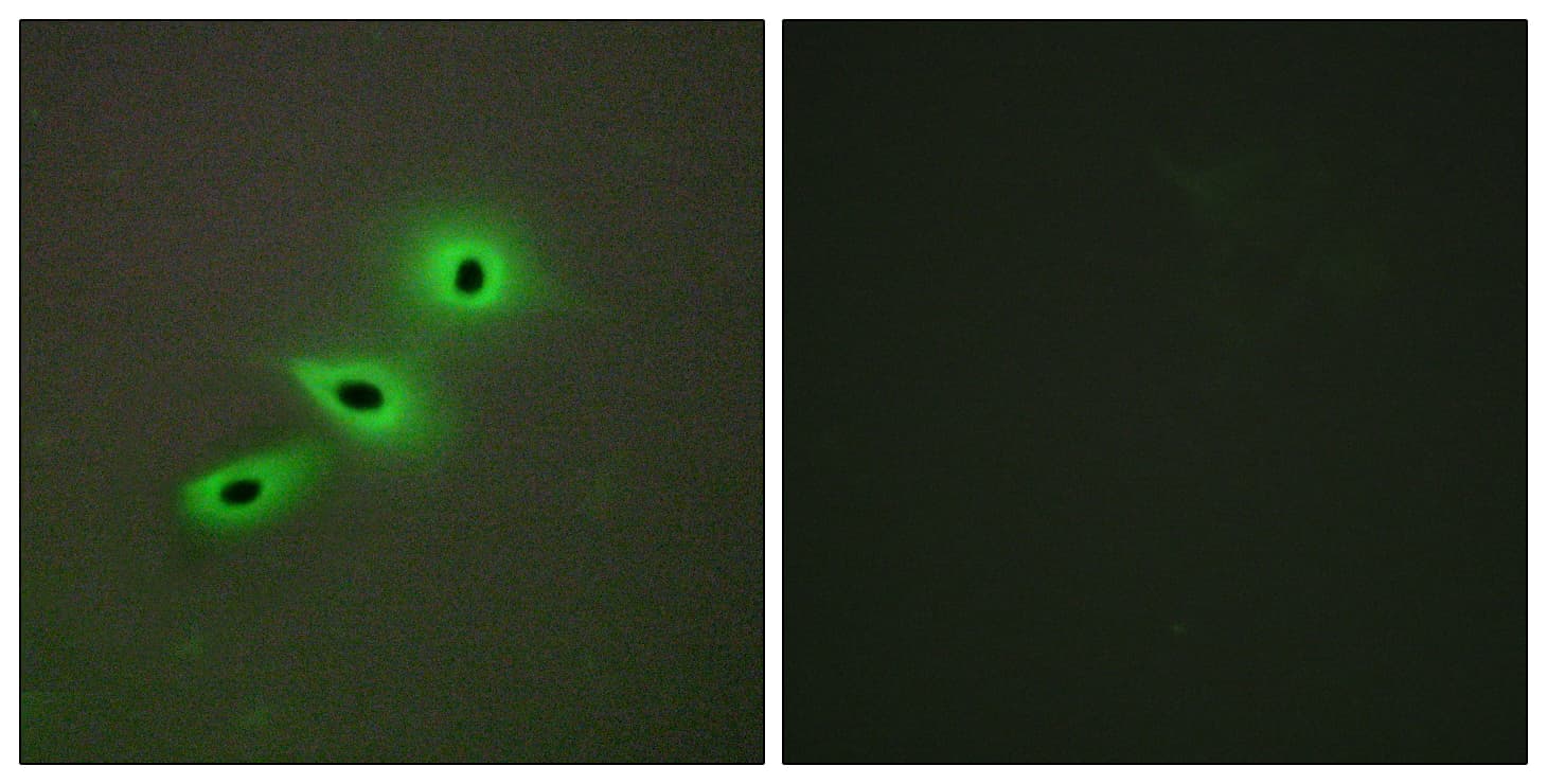 CYP19 / Aromatase Antibody (aa221-270)