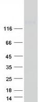 Human ITGAM / CD11b Protein (Recombinant Myc-DDK (Flag))