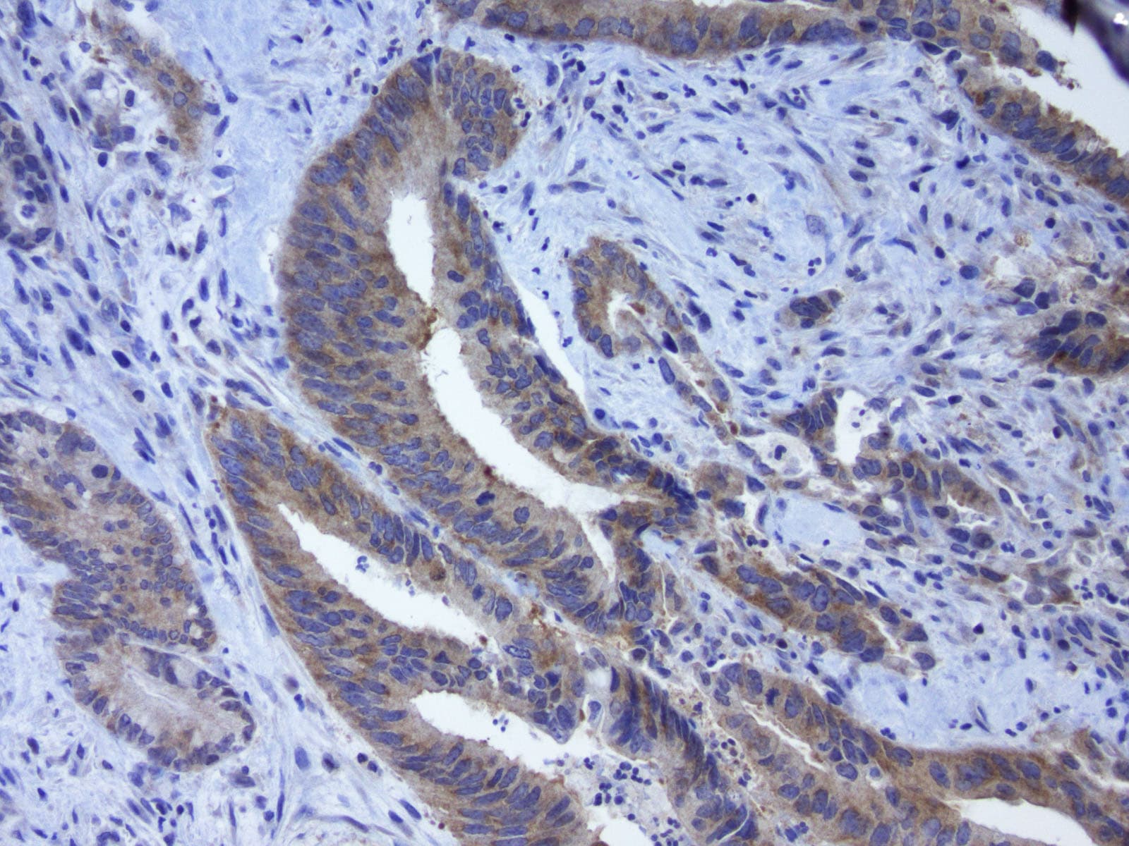 GPR49 / LGR5 Antibody (aa22-543, clone UMAB210)