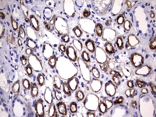 Monoclonal Mouse anti-Human MCAM / CD146 Antibody (clone OTI2G10, IHC, WB)