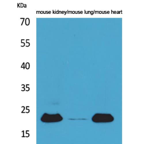ADM / Adrenomedullin Antibody (91-140 aa, Internal)