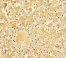 Polyclonal Rabbit anti-Human NR1I3 / CAR Antibody (WB)