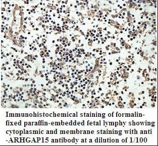 ARHGAP15 Antibody (aa277-475)