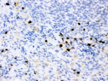 LCN2 / Lipocalin 2 / NGAL Antibody