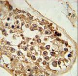 Polyclonal Rabbit anti-Human DEPDC1 Antibody (aa10-38, IHC, WB)