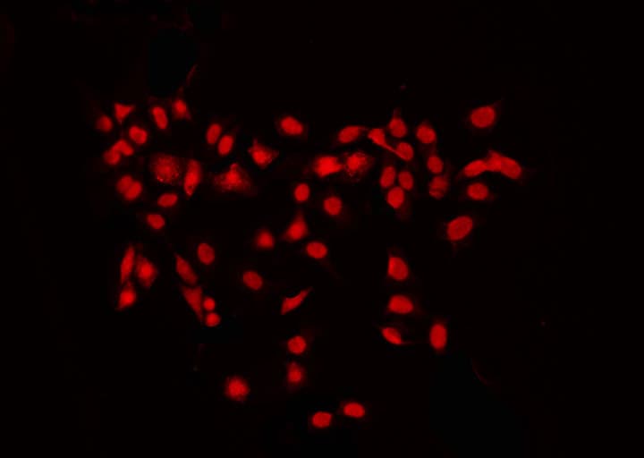 Polyclonal Rabbit anti-Human RPS6KB2 / S6K2 Antibody (phospho-Ser423, IF, WB)