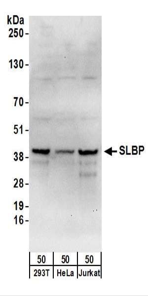 SLBP Antibody (aa220-270)