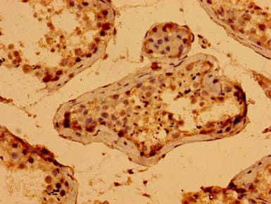 WWC2 Antibody