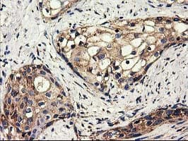 CLPP Antibody (clone OTI1F6, Carrier-free)