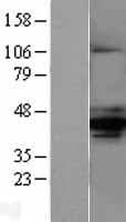 AMACR / P504S Protein (Over-Expression Lysate Myc-DDK (Flag))