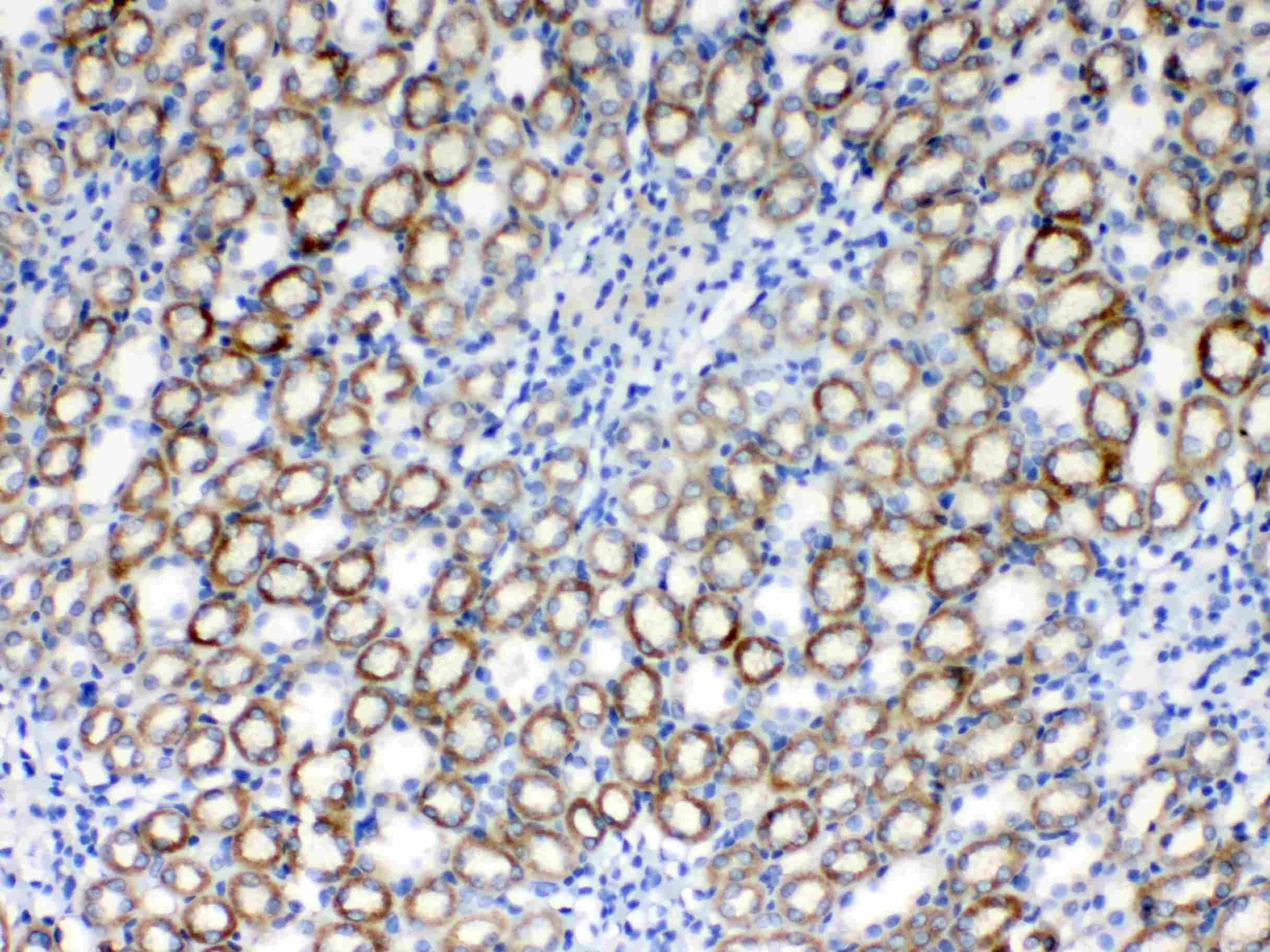 Polyclonal Rabbit anti-Human RPS6 / Ribosomal Protein S6 Antibody (IHC, WB)