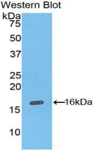 INHA / Inhibin Alpha Antibody (aa228-364)