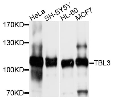 Polyclonal Rabbit anti-Human TBL3 Antibody (WB)
