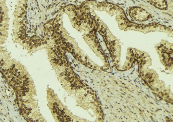 BCOR Antibody