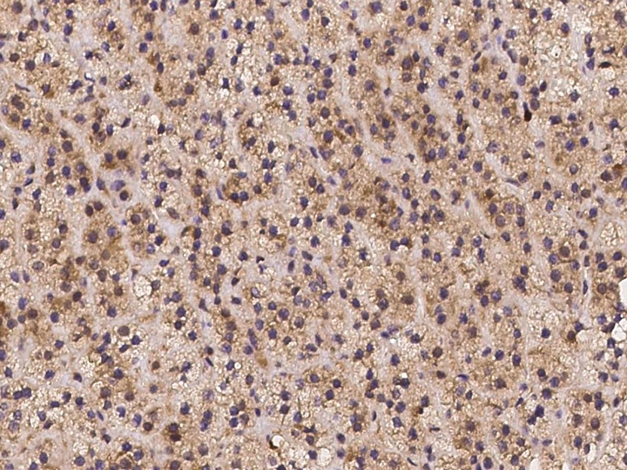 Polyclonal Rabbit anti-Human CHST12 Antibody (IHC)