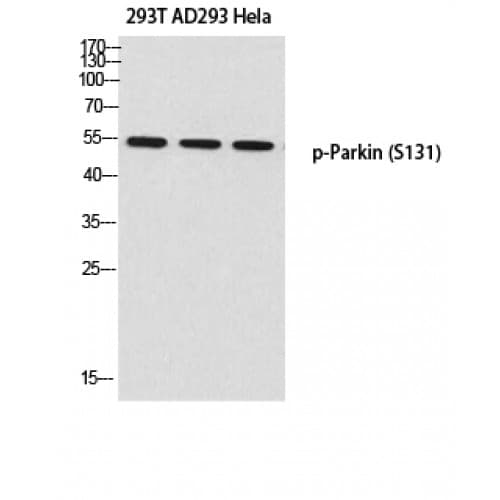 PARK2 / Parkin 2 Antibody (70-150 aa)