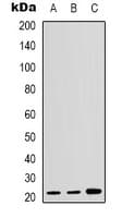 CDKN1A / WAF1 / p21 Antibody (C-Terminus)