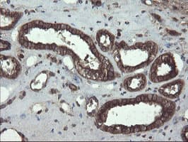 GCP60 / ACBD3 Antibody (clone OTI1G2)