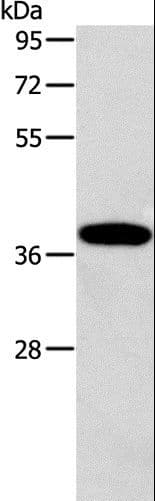 ALDOB Antibody