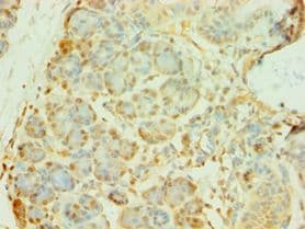 ADCK3 / CABC1 Antibody (aa1-220)