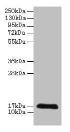 CDA / Cytidine Deaminase Antibody