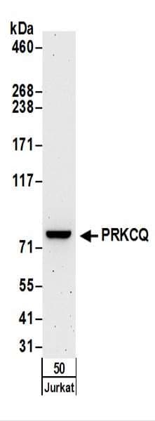 Polyclonal Rabbit anti-Human PRKCQ / PKC-Theta Antibody (aa350-400, WB)