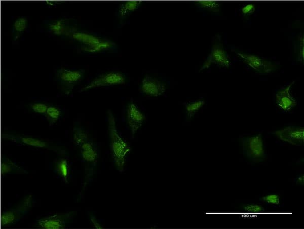 Monoclonal Mouse anti-Human HDGF Antibody (clone 2D6, IF, WB)