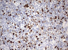 MKI67 / Ki67 Antibody (aa1160-1493, clone OTI8B11)