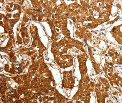 CDH23 / Cadherin 23 Antibody