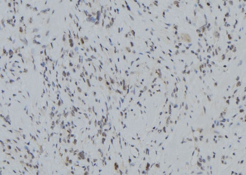 Polyclonal Rabbit anti-Human RNF123 Antibody (IHC, WB)