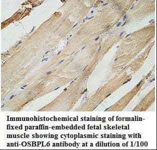 OSBPL6 Antibody (aa14-275)