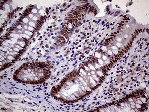 MAGEB4 Antibody (aa1-193, clone OTI3H2)