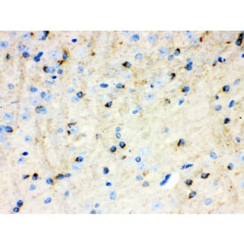Polyclonal Rabbit anti-Human APLP1 / APLP-1 Antibody (aa82-112, IHC, WB)