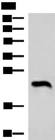 NEUROG3 / NGN3 / Neurogenin 3 Antibody