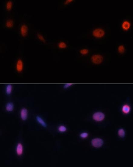 Polyclonal Rabbit anti-Human NSG1 Antibody (IF, WB)