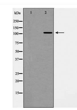 EPHA1 / EPH Receptor A1 Antibody