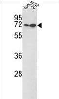 KLF4 Antibody (aa69-101)