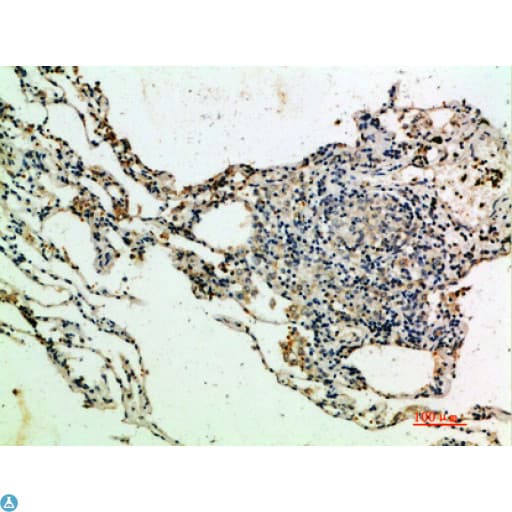 THBS4 / Thrombospondin 4 Antibody