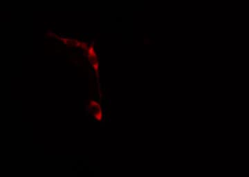 Polyclonal Rabbit anti-Human TNFSF12 / TWEAK Antibody (IHC, IF, WB)