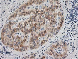BAIAP2 / IRSP53 Antibody (clone OTI8G8)