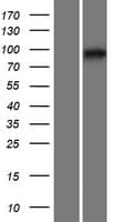 GPLD1 / GPIPLD Protein (Over-Expression Lysate Myc-DDK (Flag))