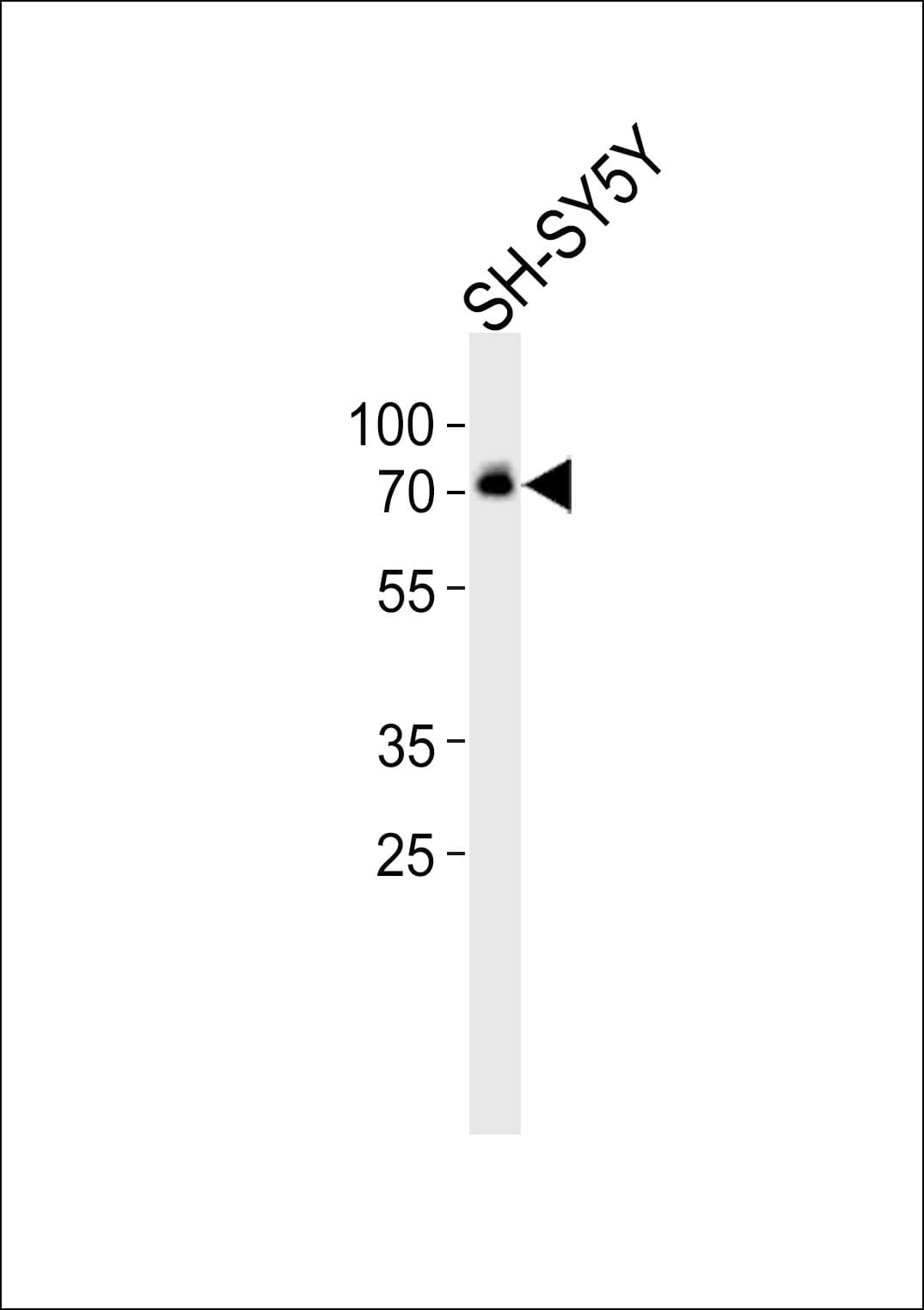 Polyclonal Rabbit anti-Human DBH/Dopamine Beta Hydroxylase Antibody (aa199-232, WB)