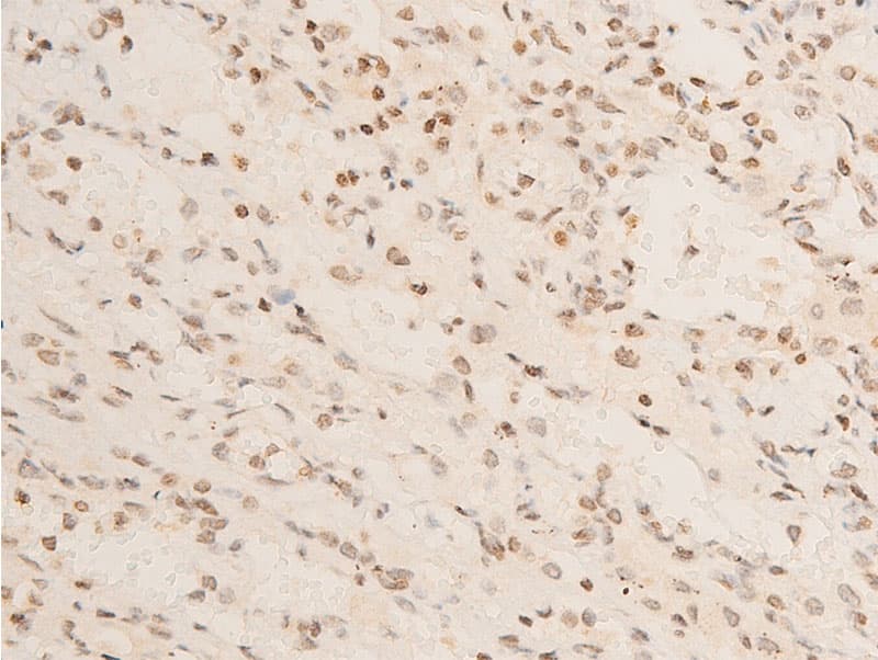 Polyclonal Rabbit anti-Human NFKBIA / IKB Alpha / IKBA Antibody (phospho-Ser32,phospho-Ser36, IHC, IF, WB)