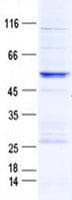 Human SNX6 Protein (Recombinant GST, N-terminus + His, C-terminus)