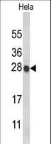 Polyclonal Rabbit anti-Human HIST1H1C Antibody (aa105-131, WB)