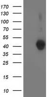 LCMT1 Antibody (clone OTI 1G5)