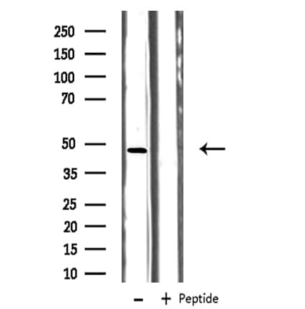 HTR1B / 5-HT1B Receptor Antibody