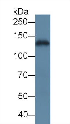 LAMC2 / Laminin Gamma 2 Antibody (aa416-602)